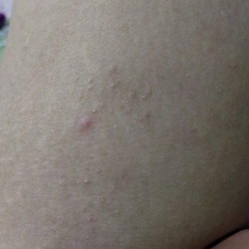 Perubahan disaat hamil