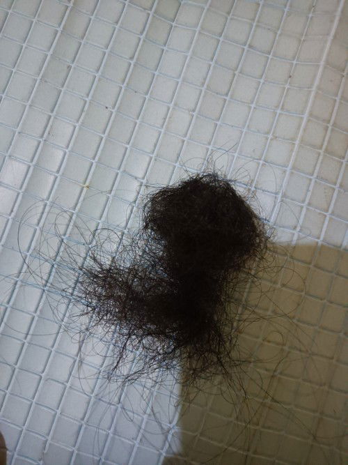 Rambut rontok saat melahirkan