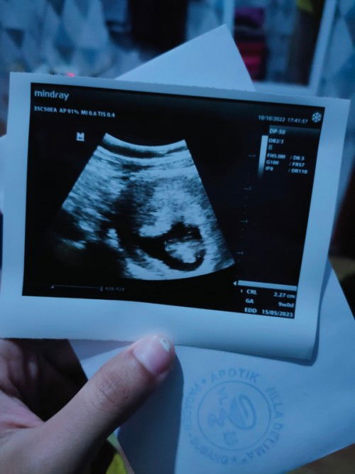 Mau tanya hasil USG