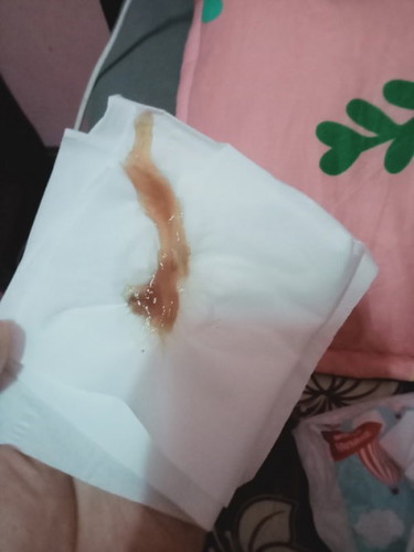 ขอสอบถามแม่ๆค่ะ