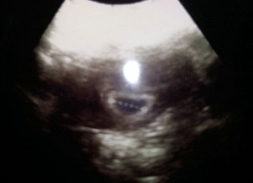 Bantu doain ya bunda😊