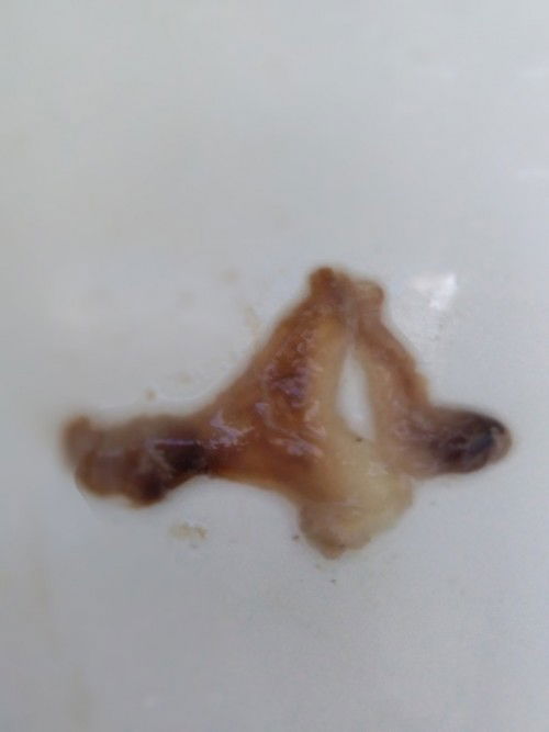 40 weeks walang
 sinyales ng labor except sa masakit Ang singit...