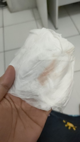ngeflek usia kehamilan 10 Minggu?