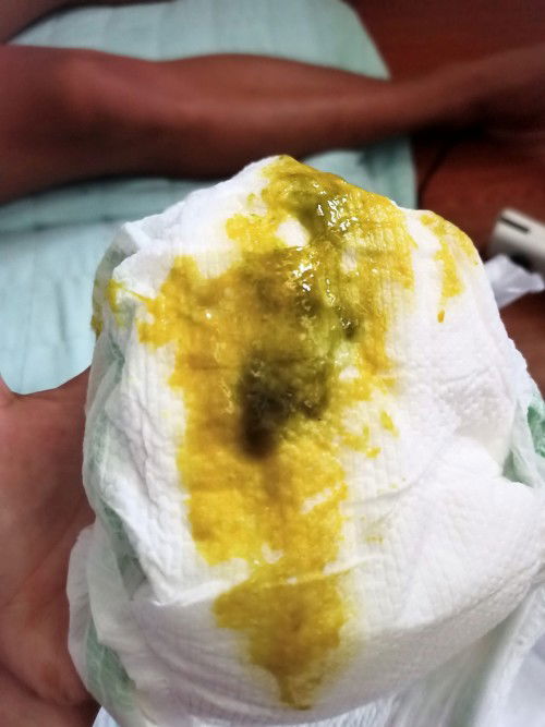 May black yung pooo ni Baby