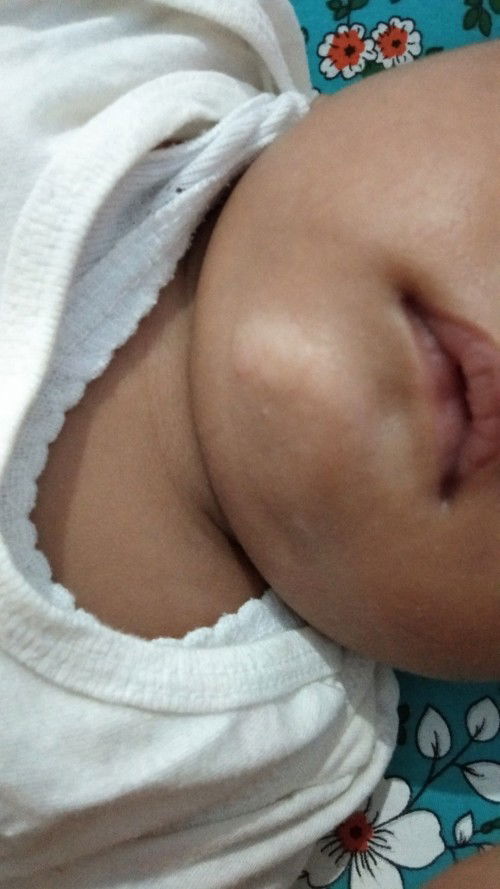 Bunda2 ada yg tau gk cara ngilangin bercak putih kasar dan kering diwajah bayi spt ini 🙏🙏