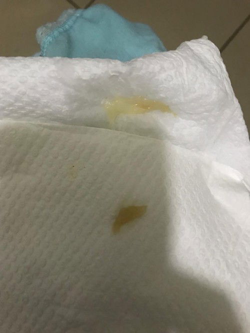 maaf nk tnya kalau mcm ni apa ye . keputihan atau lendir apa ye sy bru 33w risau pulak..