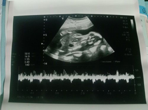 แม่ๆลองดูว่าหญิงรึชายค่ะ