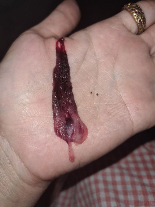 มีแม่ๆคนไหนเคยเป็นแบบนี้บ้างค่ะ