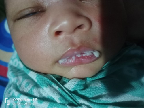 Bibir bayi putih??