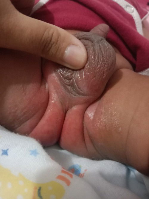 เรื่องก้นลูก