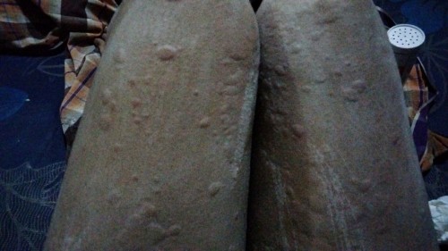 Gatal gatal seperti alergi dikasih obat apa ya bun padahal gak habis makan apa" juga tapi bentol"