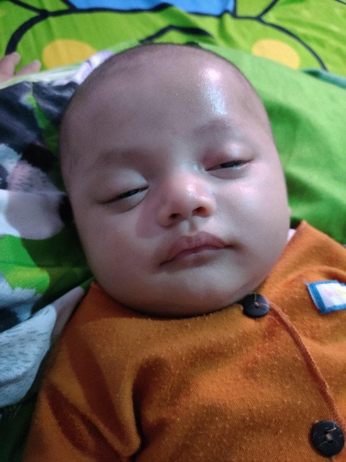 Kelopak mata merah
