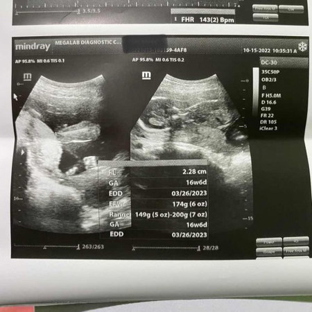 16weeks6days po