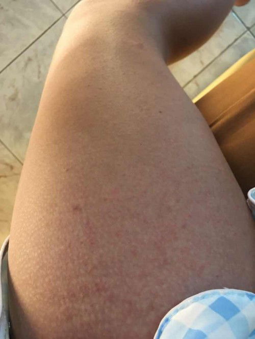 ท้อง37สัปดาห์2วันค่ะ พึ่งเป็นแบบนี้2วัน