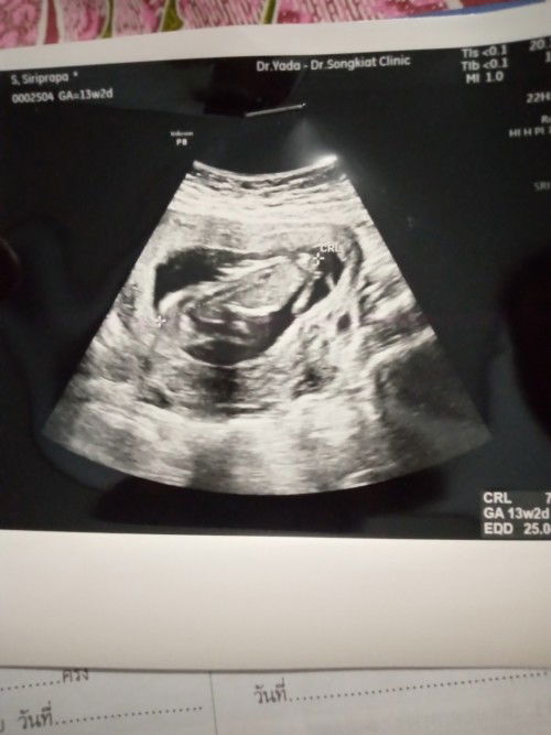 ใครพอจะทราบบ้างค่ะ ว่าน้องอยู่ท่าไหน อยู่ยังไง คุณแม่ดูไม่เป็นค่ะ