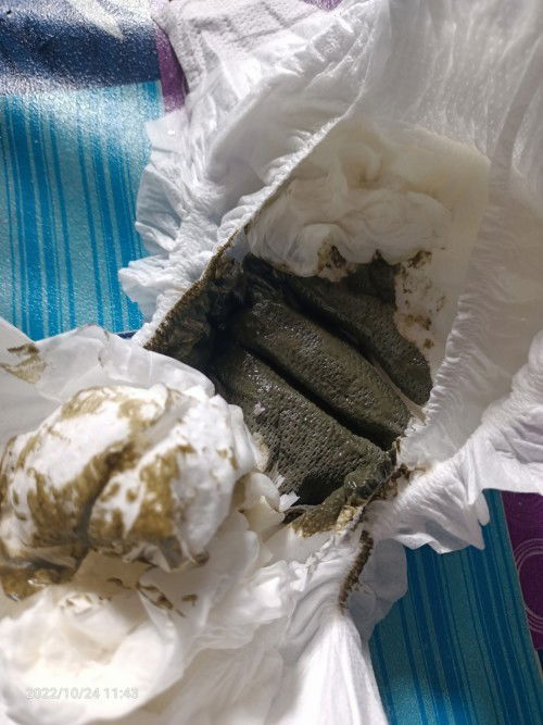 Normal ke tahi bayi 2 bulan lebih warna ini