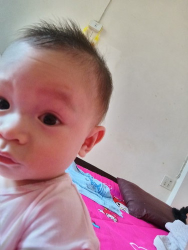 อยากถามแม่ๆว่าน้องตาแดงข้างจะหายเองไหมค่ะ