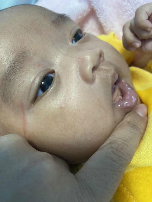 ลิ้นและปากเป็นฝ้าขาว