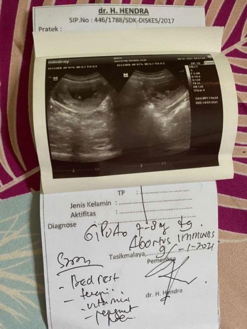 Abortus imminens adalah kondisi seperti apa?