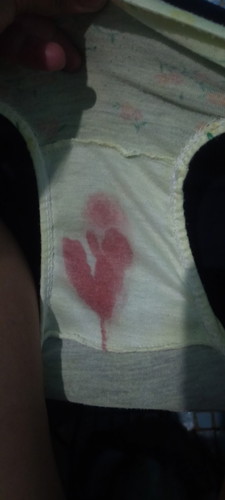 Bleeding second trimester