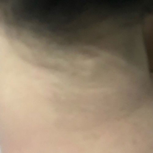 bagian tubuh menghitam