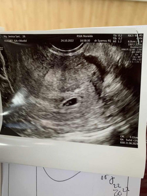 kehamilan pertama ku