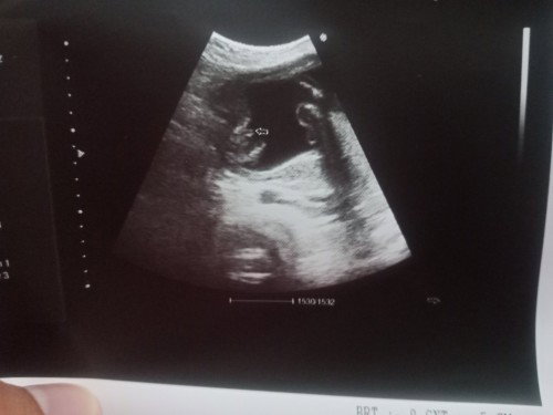 Help me guess the GENDER