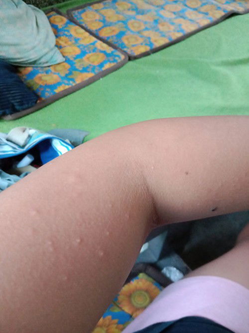 Normal lang ba to mga mii?