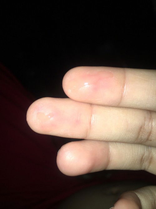 น้ำสีเหลืองใสๆไหลออกจากเต้านม