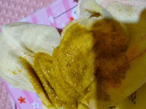 Normalkah bayi usia 3 bulan BAB 4-5 kali sehari?