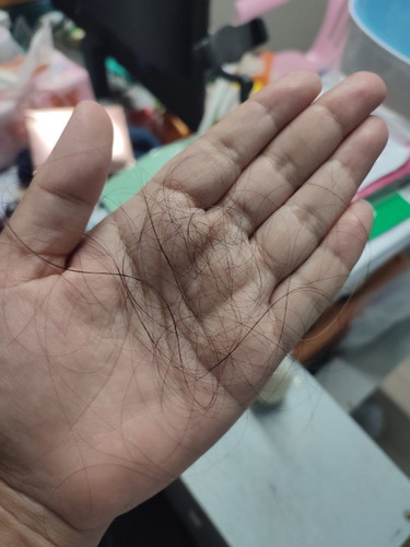 แม่ๆมีวิธีจัดการกับปัญหาผมร่วงหลังคลอด แบบไหนกันบ้างค่ะ