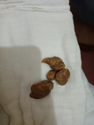 Najis bayi keras
