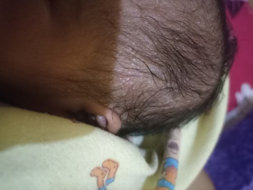 Buang keringat pada anak