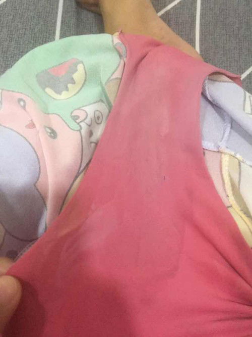 Watery Discharge @9 weeks & 5days preggy is normal?