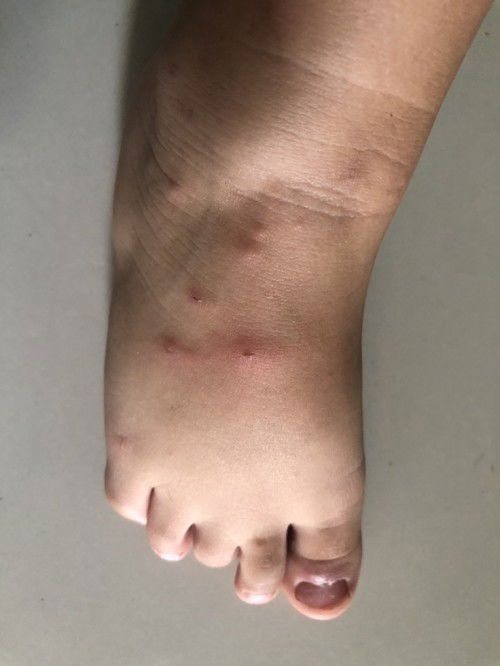 ขอวิธีรักษาค่ะ