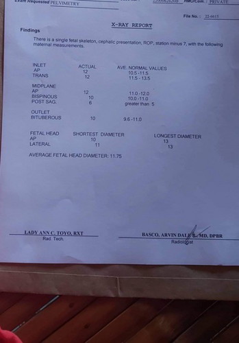 Pelvimetry xray result