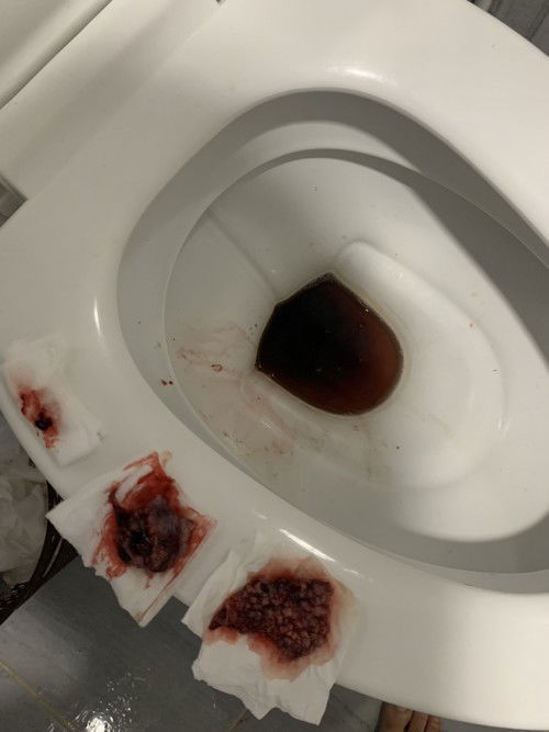 แบบนี้แท้งแล้วใช่ไหมค่ะ