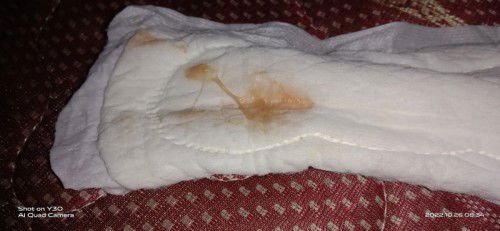 Bingung tanda mau lahiran sebenar nya..