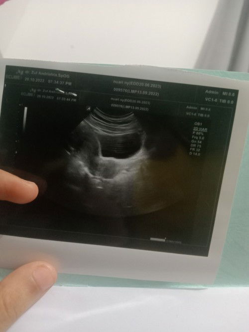 Selamat siang saya mau tanya ini mksud hasil nya ini gimna ya ???