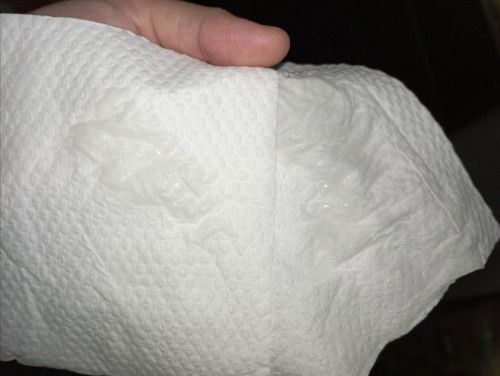 32w 5d . ada cecair keluar dari bawah .