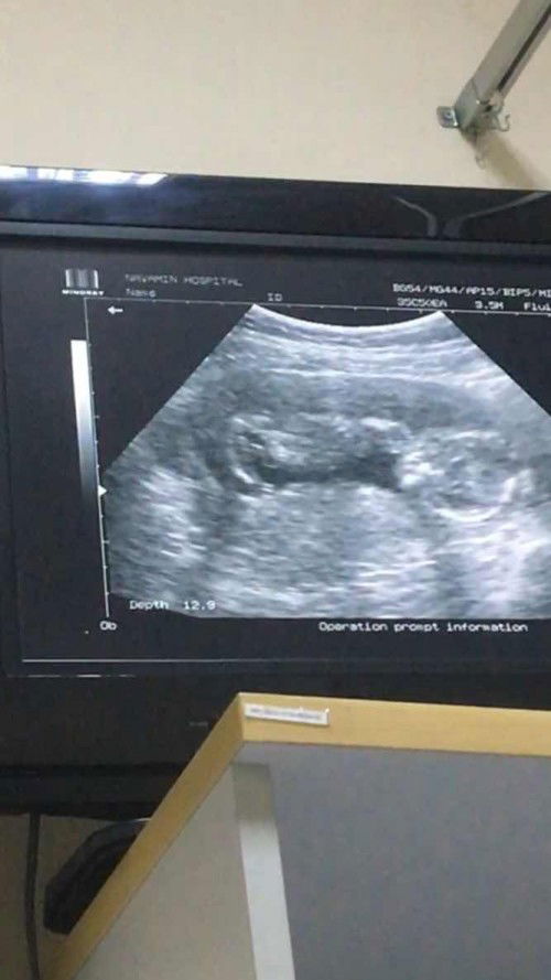 แบบนี้เรียกว่าท่านอนปกติมั้ยคะ