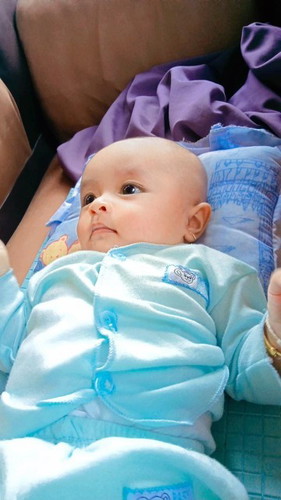 Dahi bayi menonjol