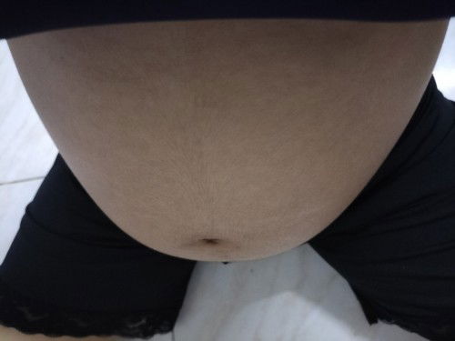 27สัปดาห์ตรวจพบสายสะดือพันคอ คุณแม่มีวิธีการใด ที่จะแก้ปัญหาบ้างค่ะ