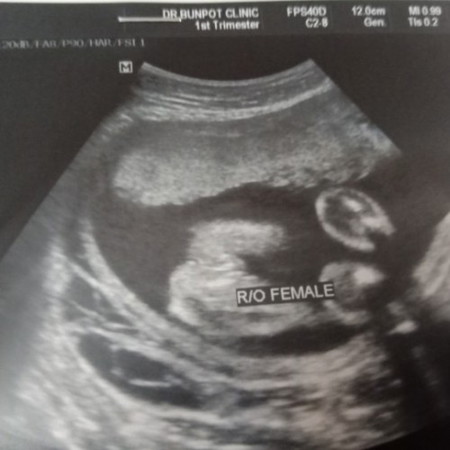 ภาพอัลตร้าซาวช่วยดูหน่อยจ้าว่าใข่เพศหญิงชัวๆเลยไหม 😀😀