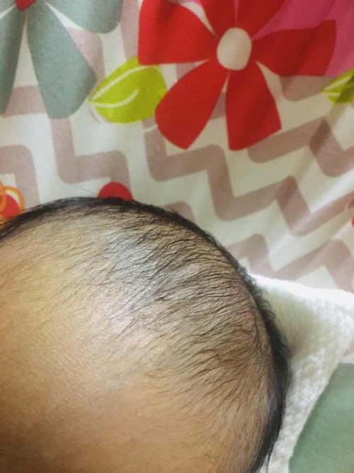 Bunbunan ni Baby!