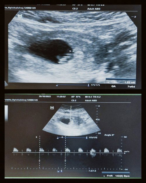 คุณแม่ท้องแรกค่า