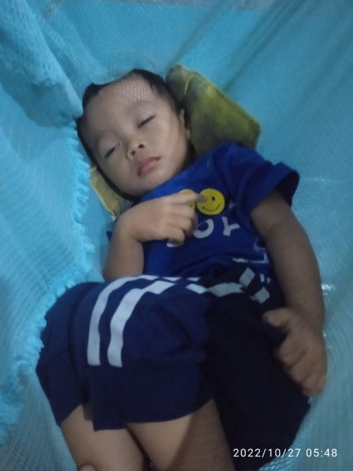 Demam turun naik suhu badan