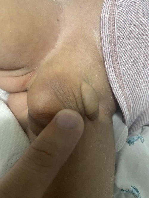 Có ai gặp trường hợp này ko giúp mình với