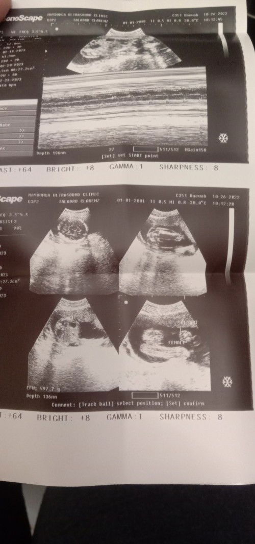 Girl poba sya pabasa naman po?