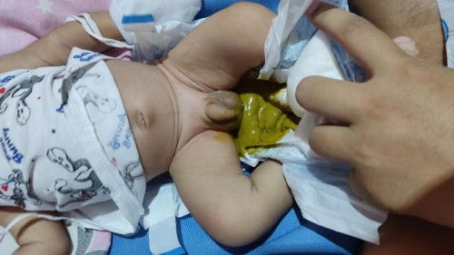 NAGTATAE 1 month old